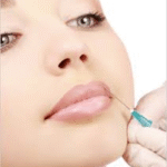 Understanding Dermal Fillers